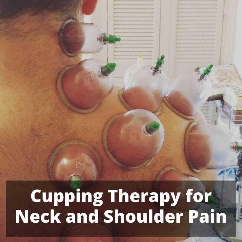 Cupping Therapy for Pain PRP Treatment center