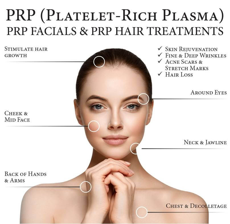 Treatment prp Is PRP