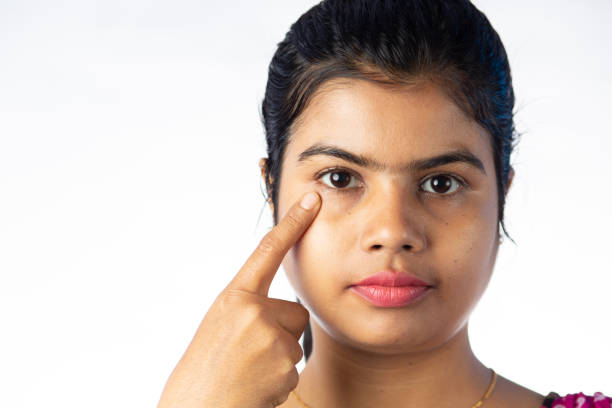 Dark Circle Treatment in Delhi