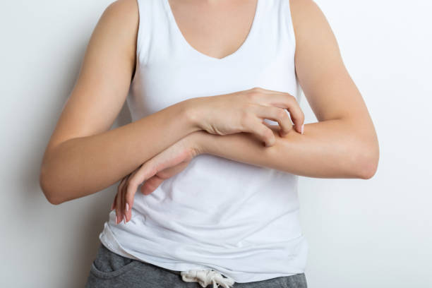 Fungal Skin Infection Treatment Delhi