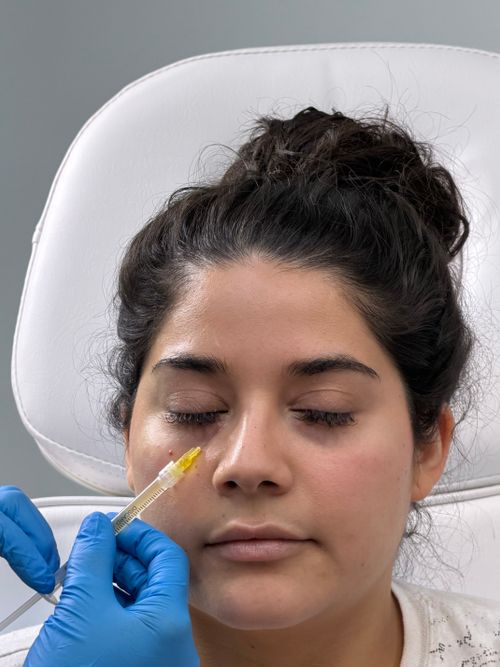 GFC for Fine Lines and Skin Texture
