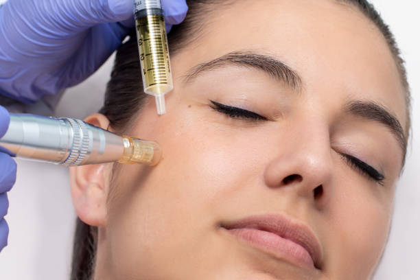 GFC for Skin Rejuvenation Karol Bagh