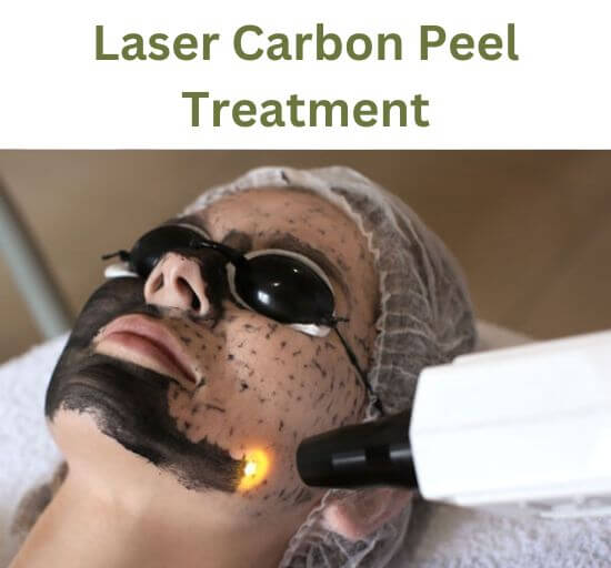 Laser Carbon Peel Treatment in Delhi for brighter and smoother looking skin
