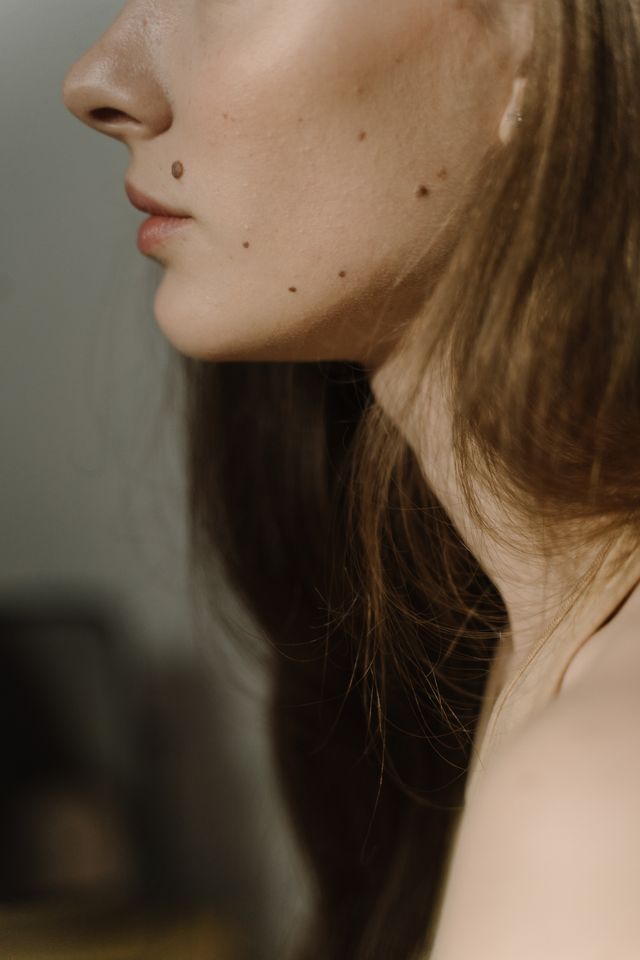 Warts and skin tags removal treatment