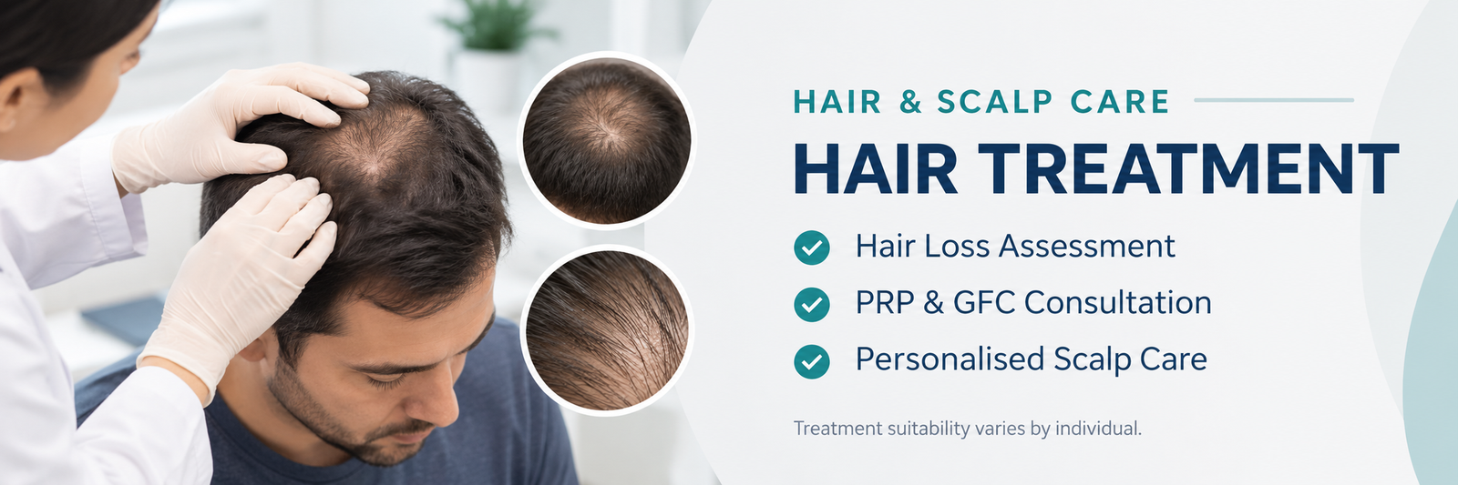 Hair loss assessment and PRP GFC hair treatment in Karol Bagh Delhi